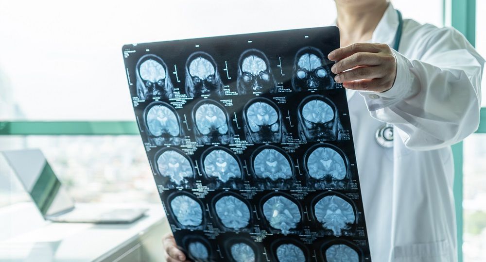 Diagnosi di Alzheimer: come si fa e quali esami servono?