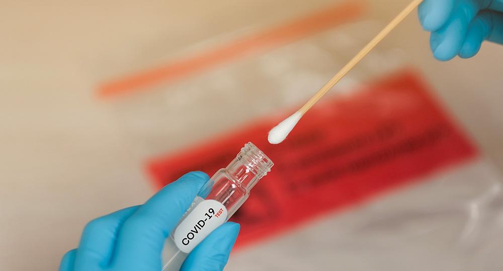 Test e Tamponi a domicilio per la rilevazione qualitativa dell’antigene Covid-19 a Tortona