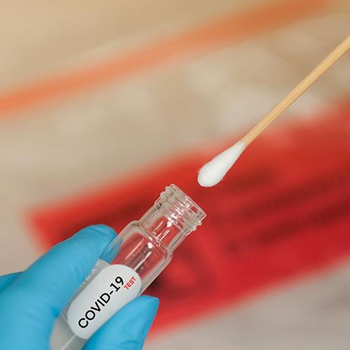 Test e Tamponi a domicilio per la rilevazione qualitativa dell’antigene Covid-19 a Tortona